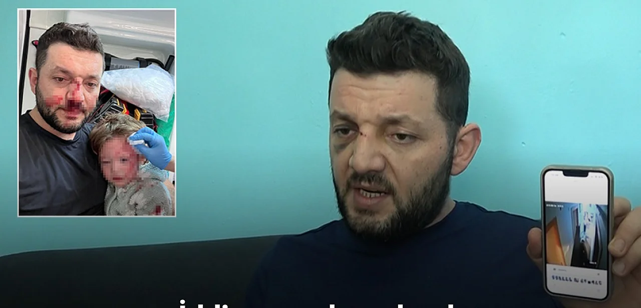 Yalova’da baba ve 14 aylık kızına saldıran zanlının 36 yıla kadar hapsi istendi