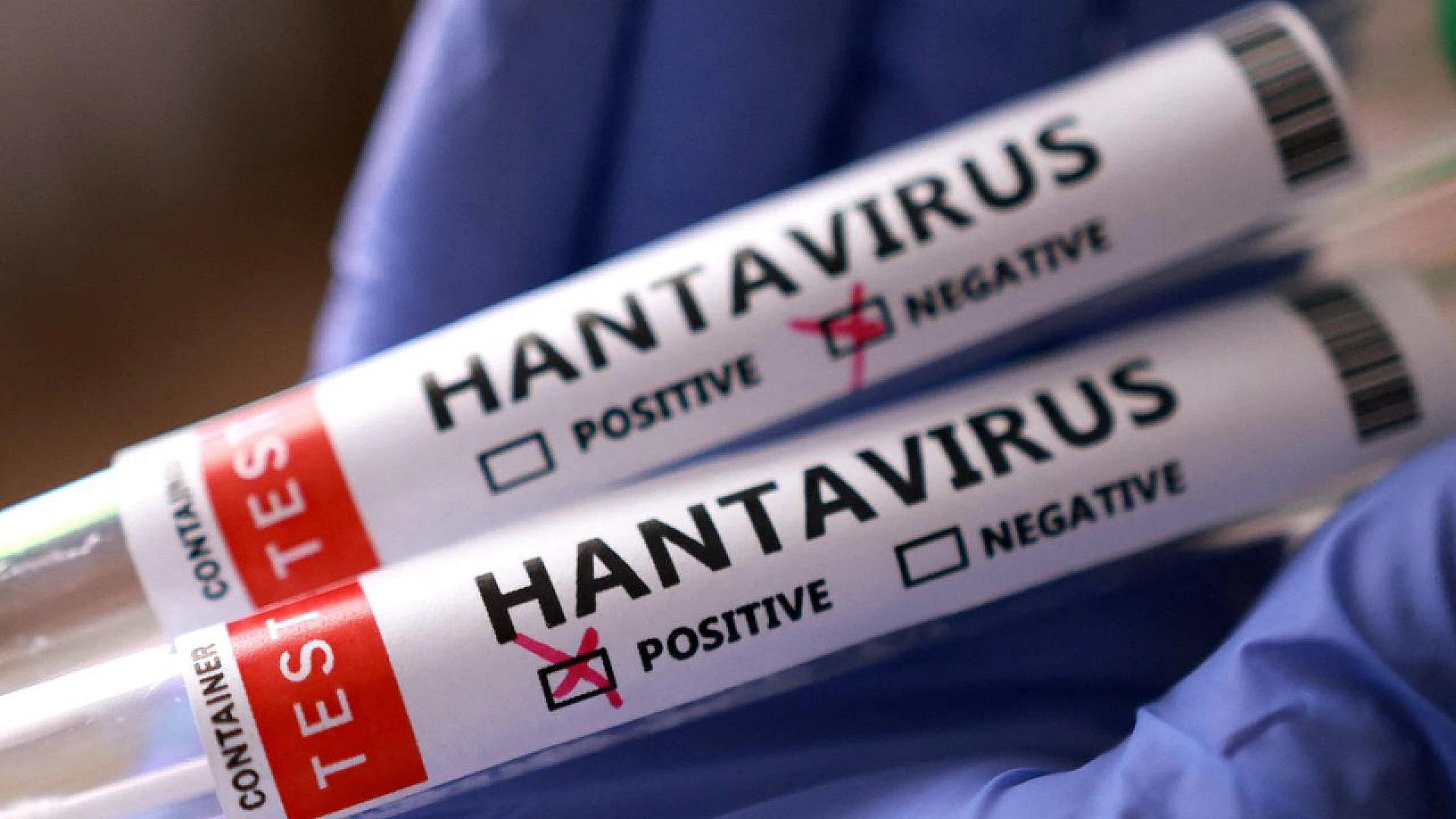 Hantavirüs vakalarına dair yazılı bir açıklama yayımladı