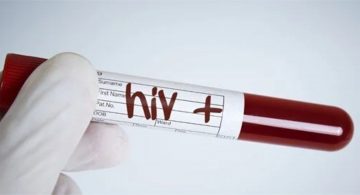 HIV enfeksiyonunu kontrol altına almak mümkün
