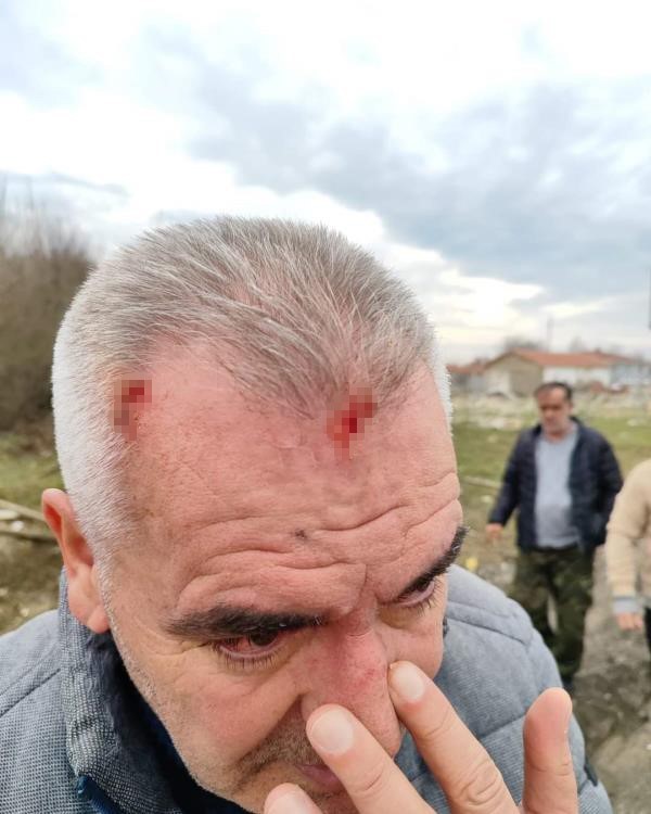 Lüleburgaz’da olaylı maç: Rakip takım taraftarlarına saldırı